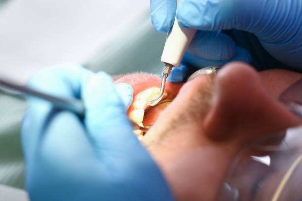 Best Emergency Treatment for Jaw Pain or Injury in Clarcona, FL